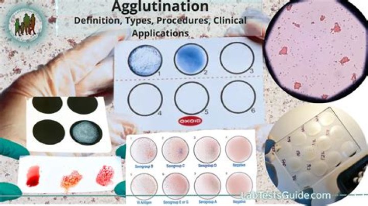 How does the agglutination test work