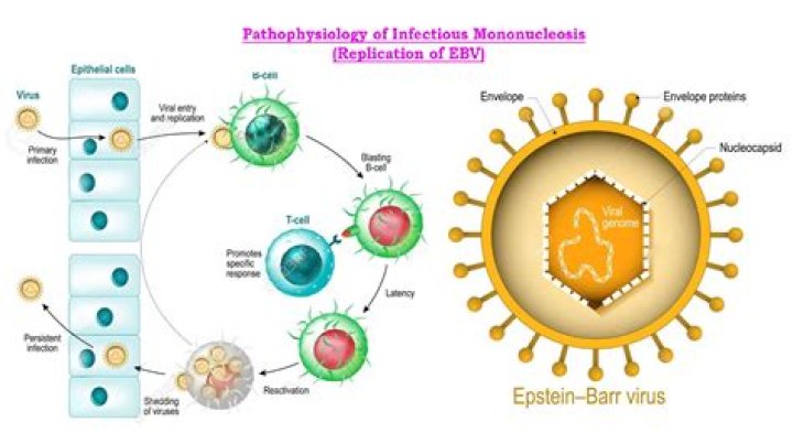 Why is Heterophile antibody produced during EBV infection